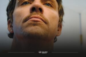 Como Afinar o Rosto Naturalmente: 8 Estratégias Para Destacar Seus Traços Faciais